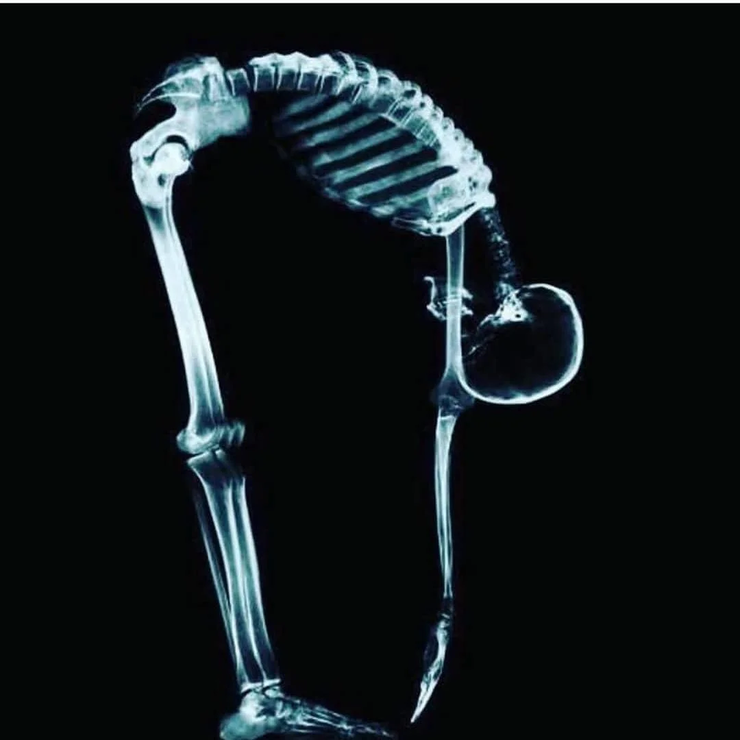 Imagen radiográfica de la columna vertebral en movimiento